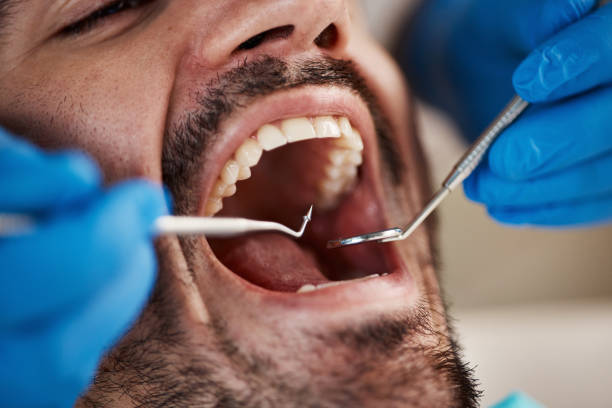 Best Pediatric Emergency Dentist in Gberts, IL