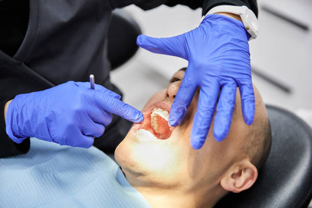 Best Emergency Tooth Extraction in Gberts, IL