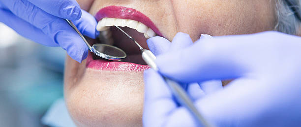 Best Emergency Tooth Extraction in Gberts, IL